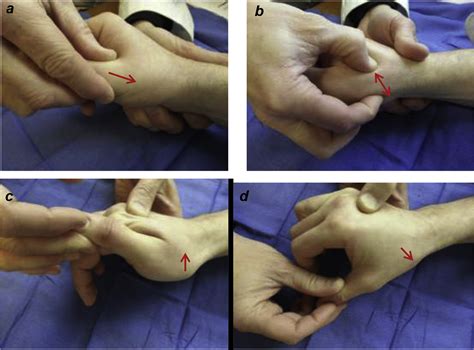 metacarpal compression test|thumb carpometacarpal joint.